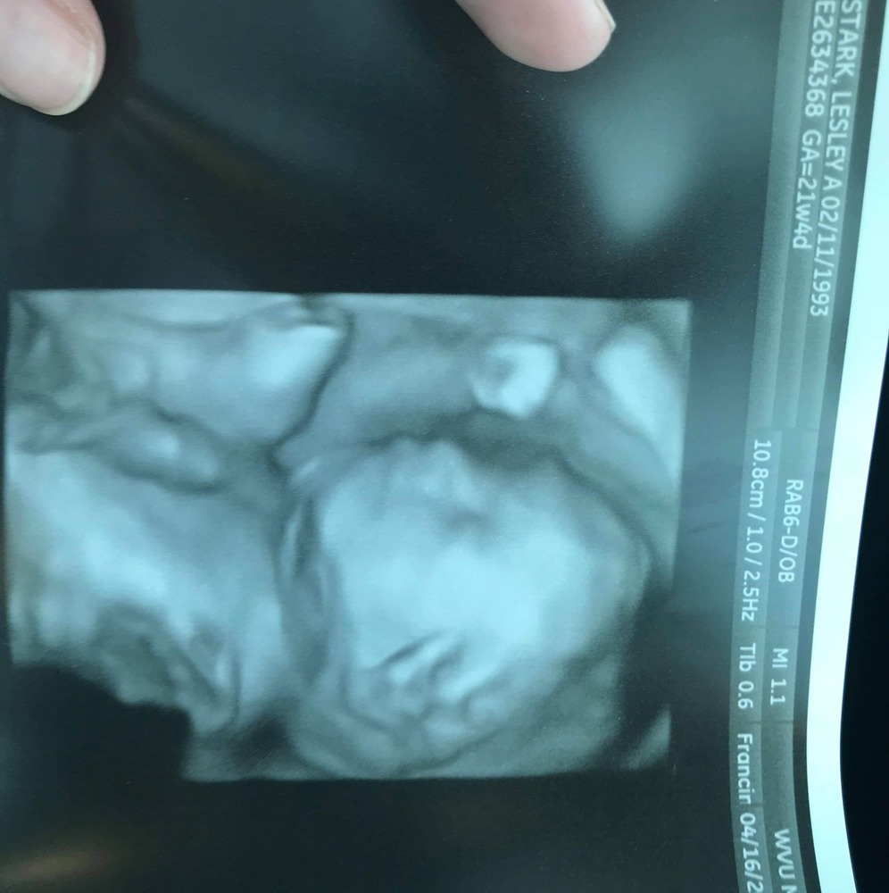 Meet your Posher, Sharon